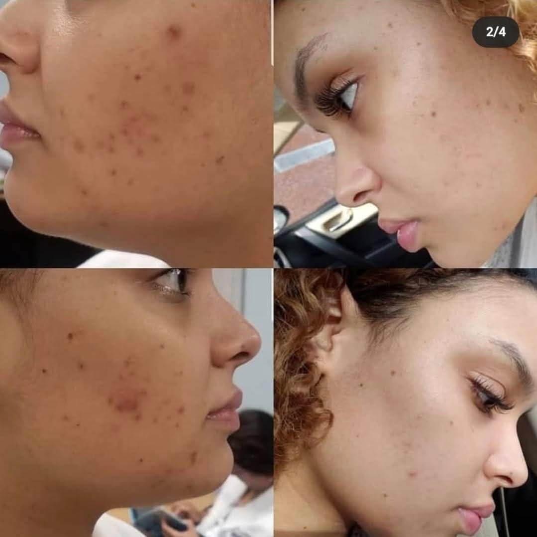 DARK SPOT SERUM